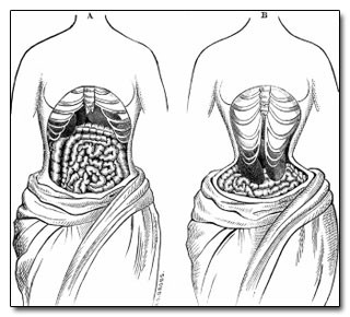 Image:  Internal organs while wearing a corset.