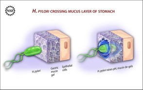 H. Pylori Crossing Mucus Membrane in Stomach Lining
