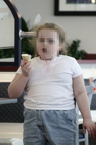 Childhood Obesity is Frighteningly Common