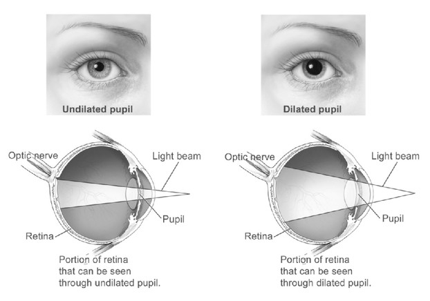 eye examination; portions of retina as seen through undilated pupil and dilated pupil