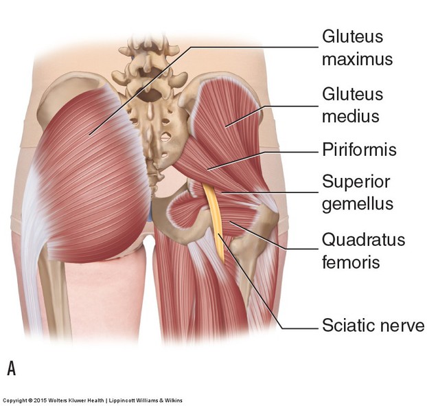 Piriformis and sciataica nerve