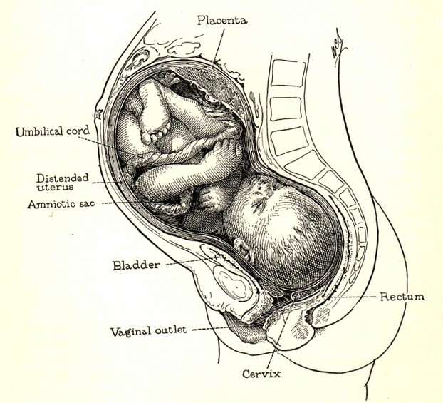 The best position for a placenta - Top Posterior (At the top, back of the uterus.) 