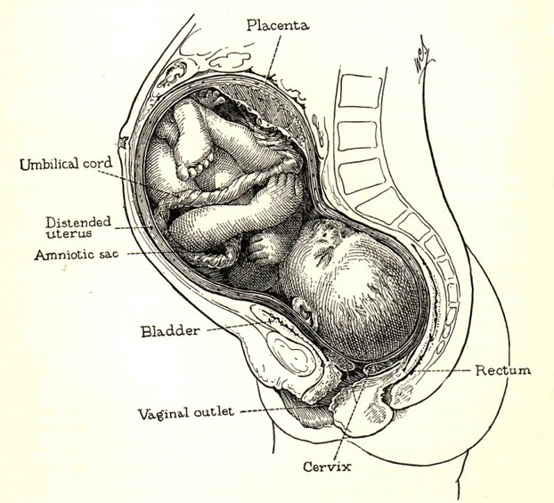 Will A Posterior Low Lying Placenta Move