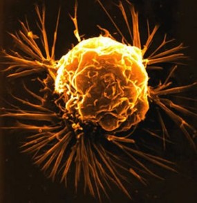 Cancer Cells In LARGE clusters Are Tumors