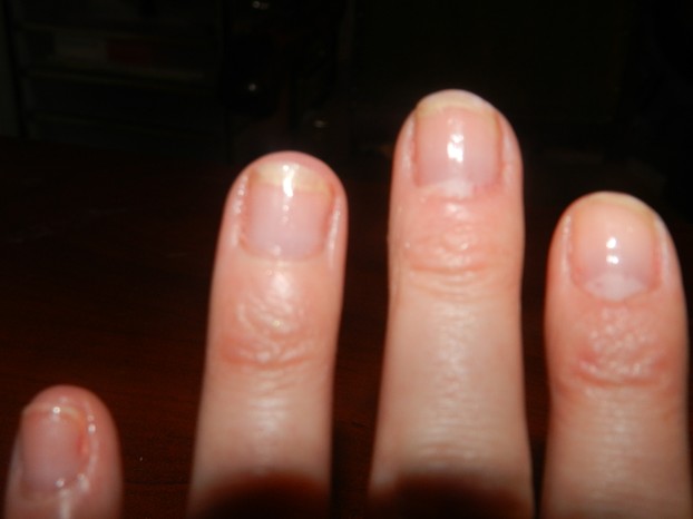 How to Heal Nails After Acrylics