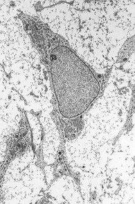 A mesenchymal stem cell