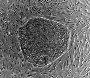Colony of human embryonic stem cells