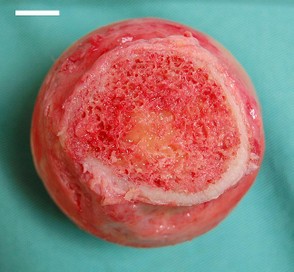Femoral head with the bone marrow exposed