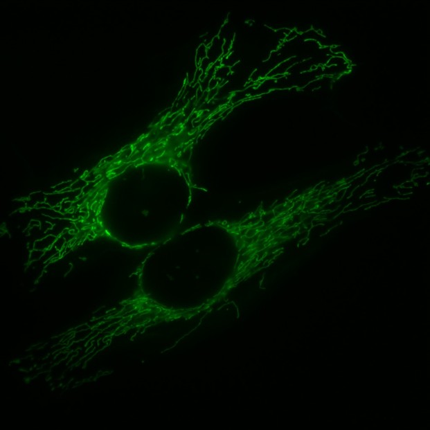 "Fluorescent microscopy picture of HeLa cells expressing a mitochondrially targeted version of green fluorescent protein (mtGFP)"; Monday, Dec. 22, 2014
