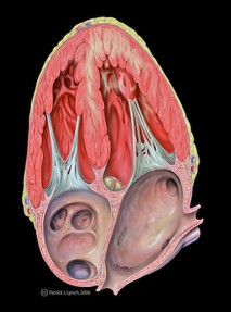 Heart with Anterior Wall Dysfunction, image by Patrick J. Lynch