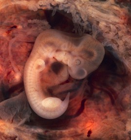 A growing fetus