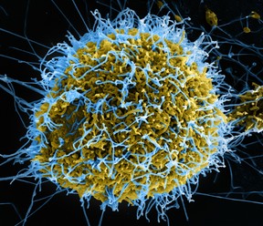 Ebola (blue) invading a cell (yellow)